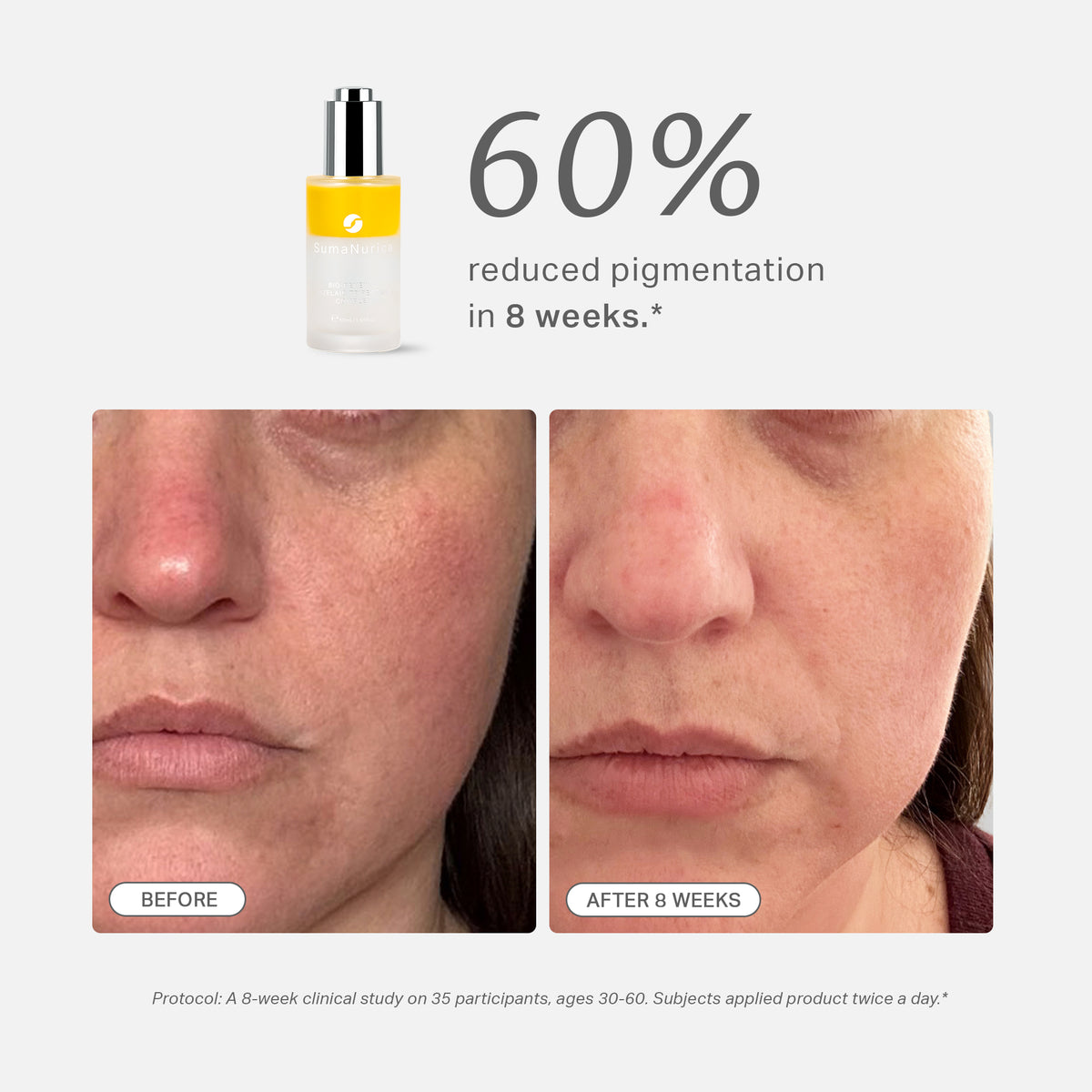 Limited Edition Anti-Ageing Renewal Kit